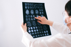 Medical professional in a white coat and mask reviewing a dark film sheet displaying multiple grayscale axial slices of a brain MRI scan